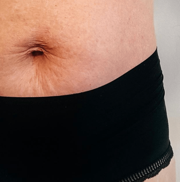 Dear stomach, I don’t hate&nbsp;you